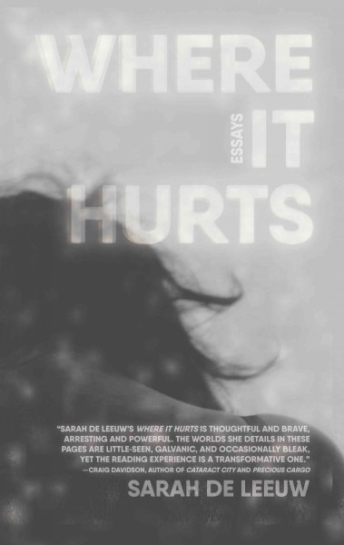 Where it hurts : essays / Sarah de Leeuw.